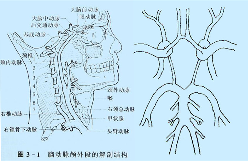 腦動脈顱外段的右側面圖Willis環的模擬圖.jpg
