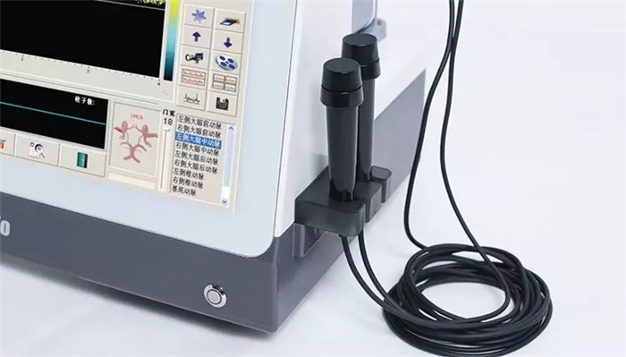 TCD廠家知識科普之什么是經顱多普勒 TCD廠家知識科普之什么是經顱多普勒