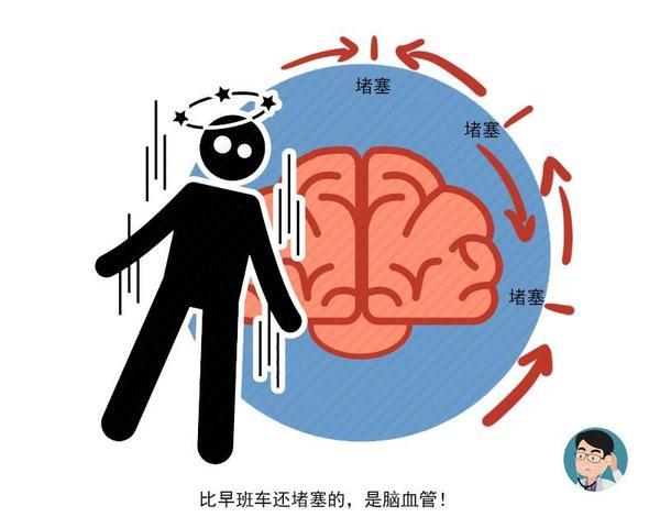 腦中風(fēng)發(fā)作前的四個(gè)癥狀 謹(jǐn)防中風(fēng)猝死 腦中風(fēng)發(fā)作前的四個(gè)癥狀 謹(jǐn)防中風(fēng)猝死