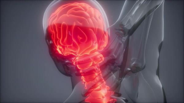 腦出血發生時的癥狀 發病突然致殘率高